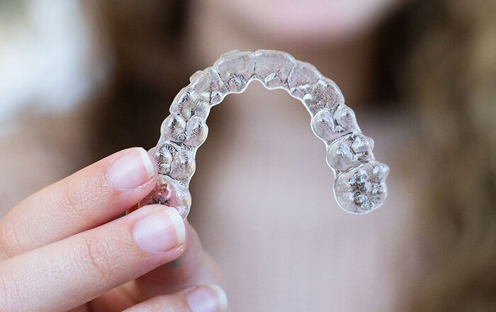 How Invisalign Aligners Fit Into Your Busy Lifestyle