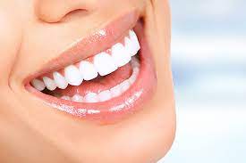 The Science Behind Professional Teeth Whitening